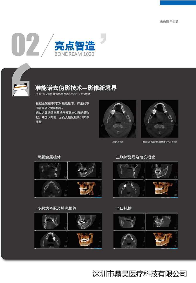 伯爵CBCT