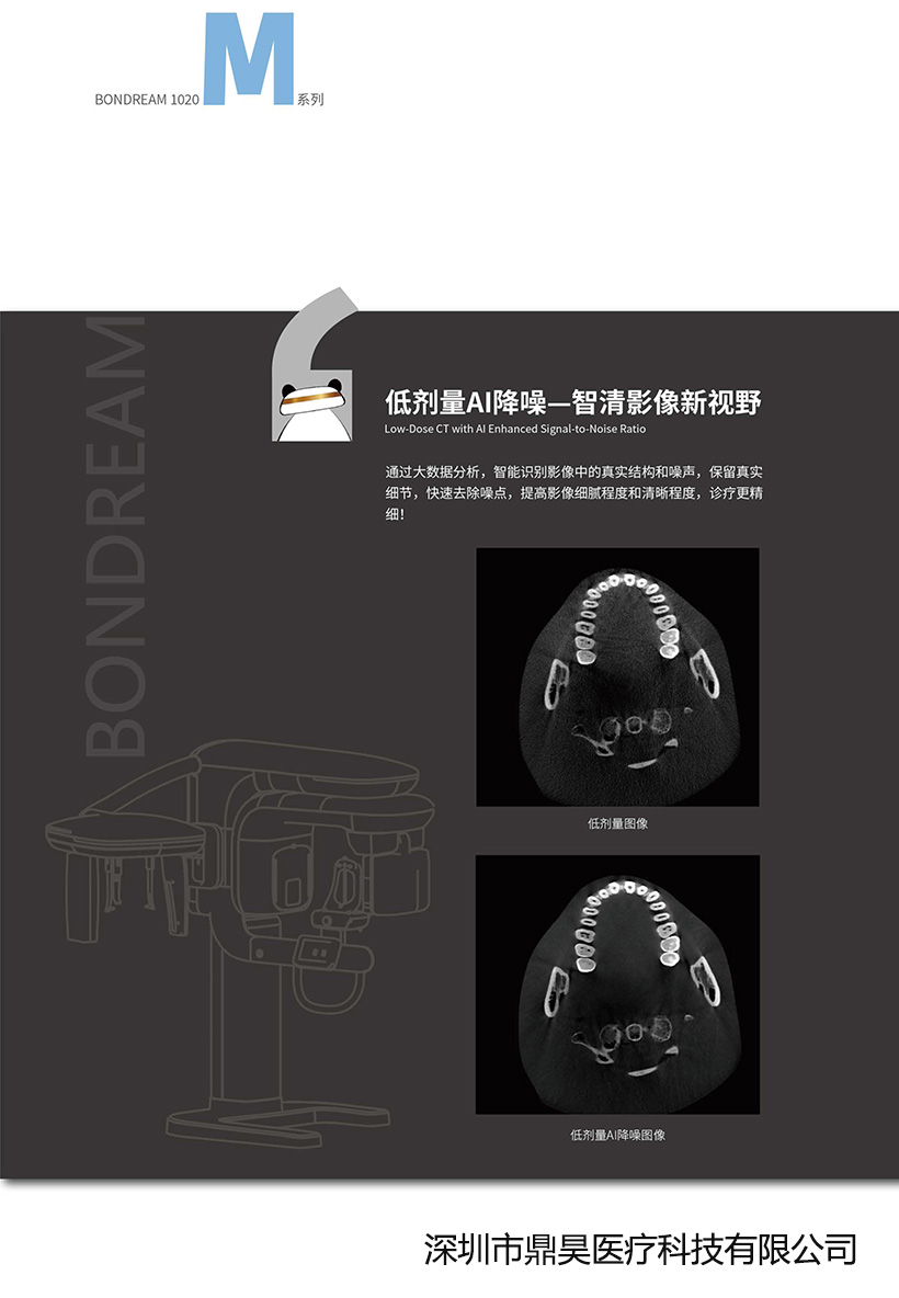 博恩登特CBCT