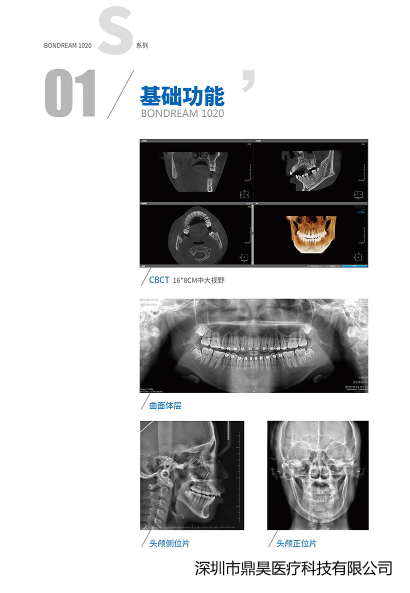 伯爵S CBCT